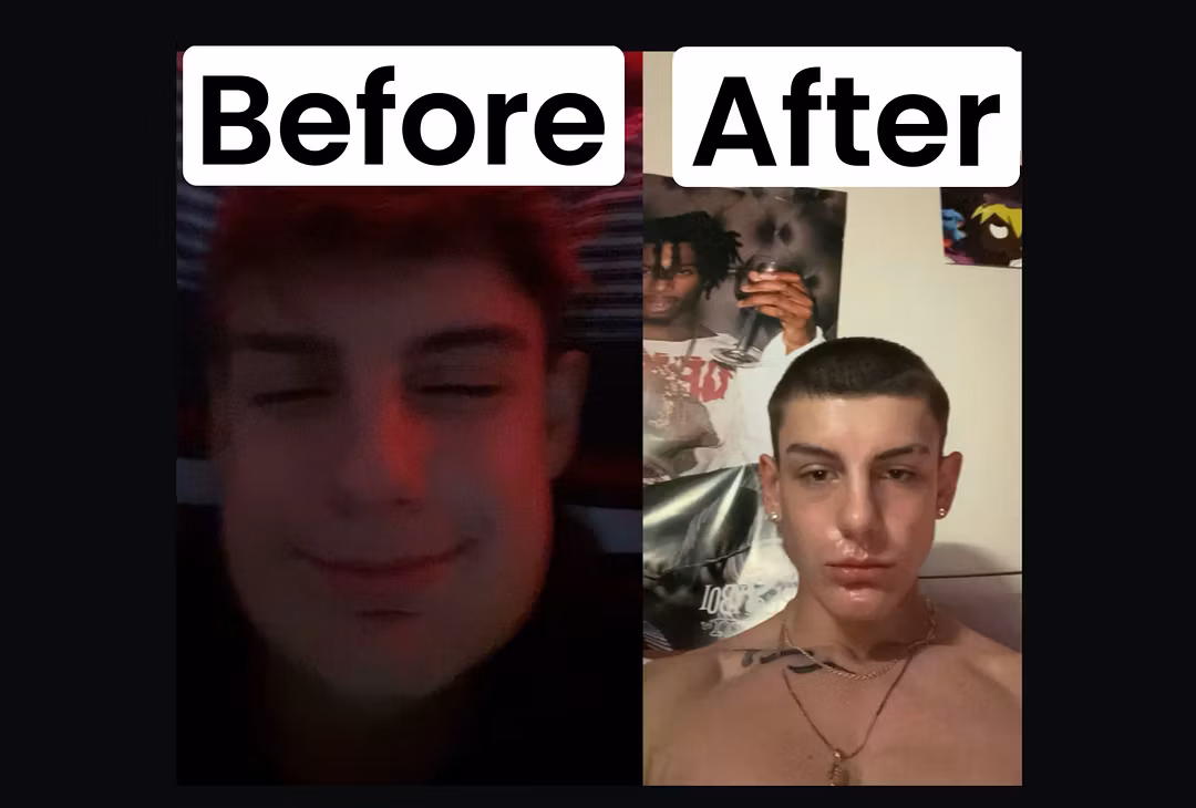 double image