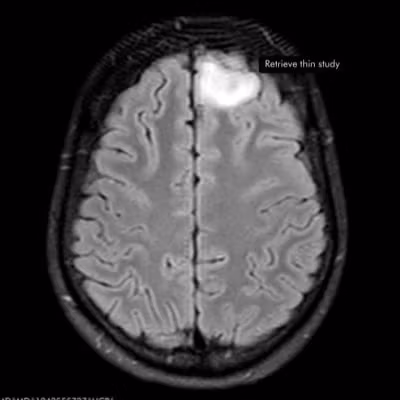 AI engine to ideate and test new offer angles fast • Done-with-you ad creative, scripts and funnels for paid traffic • Battle-tested frameworks for YouTube, TikTok and UGC • Built for marketers who want higher-converting offers, not more busywork