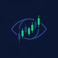 ChartVision