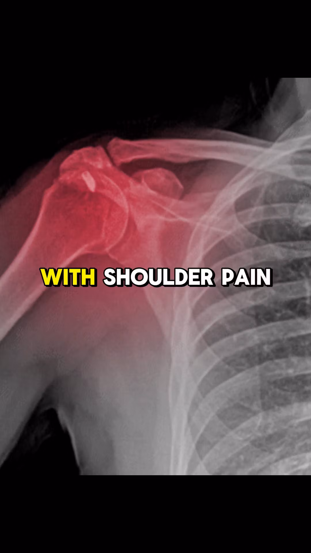 Eliminate shoulder pain