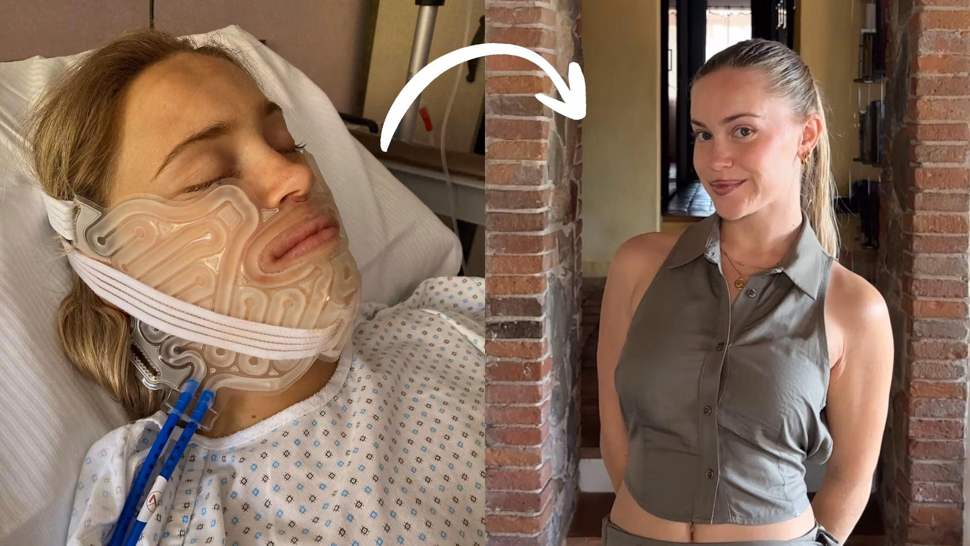 My Complete Jaw Surgery Guide