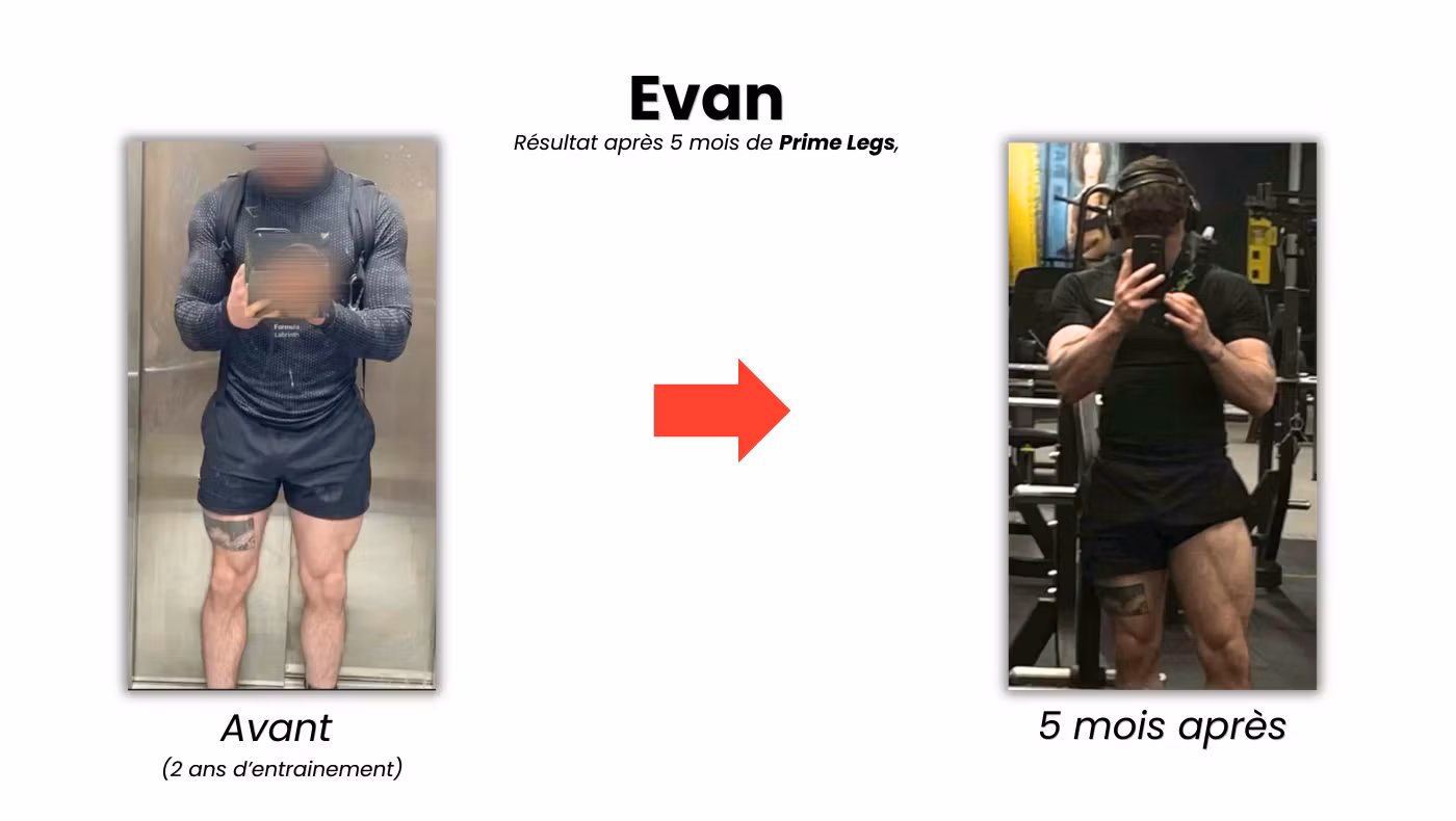 Prime Legs