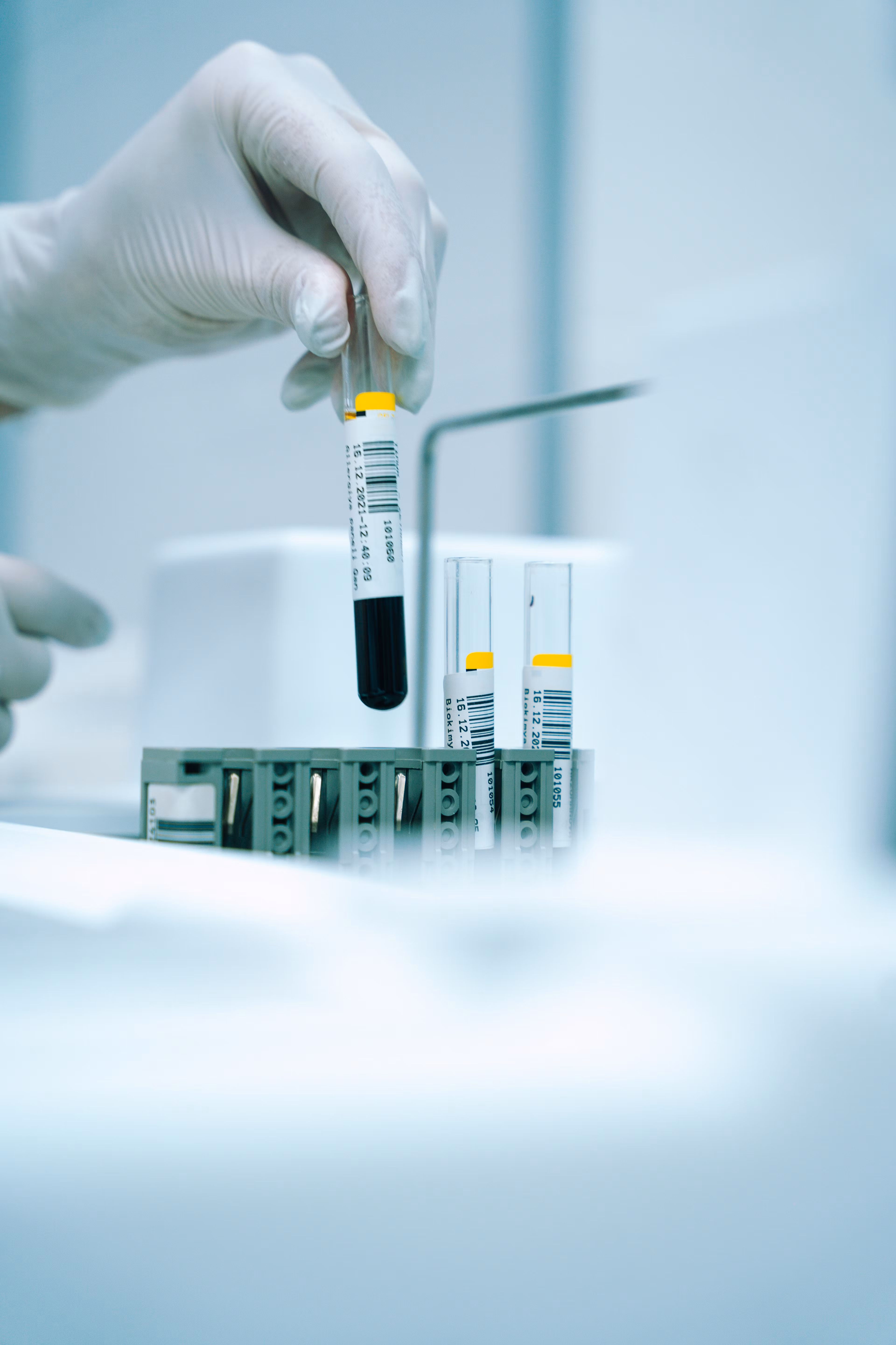 Gut Iron and Ferritin Recovery