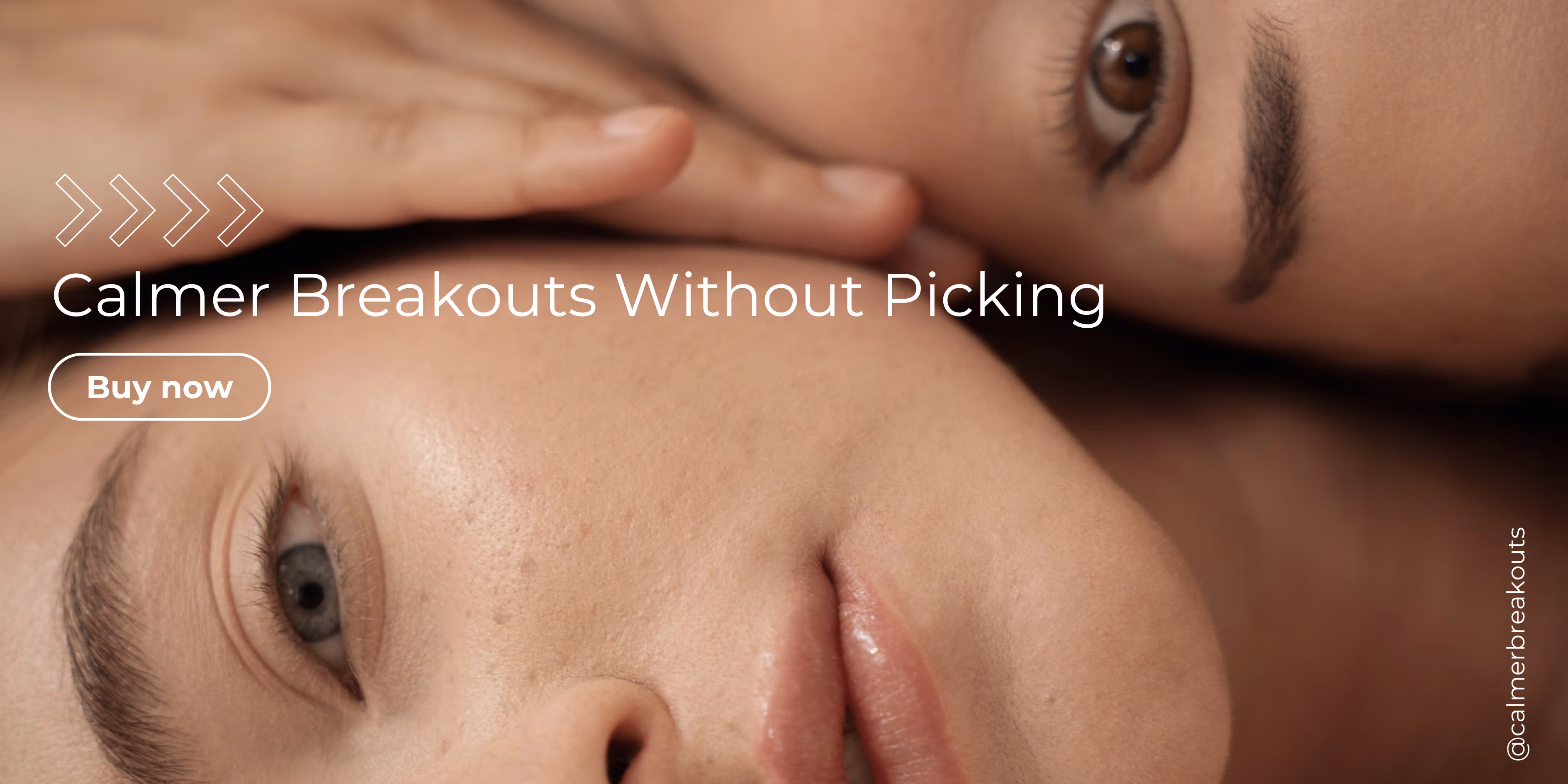 Calmer Breakouts Without Picking