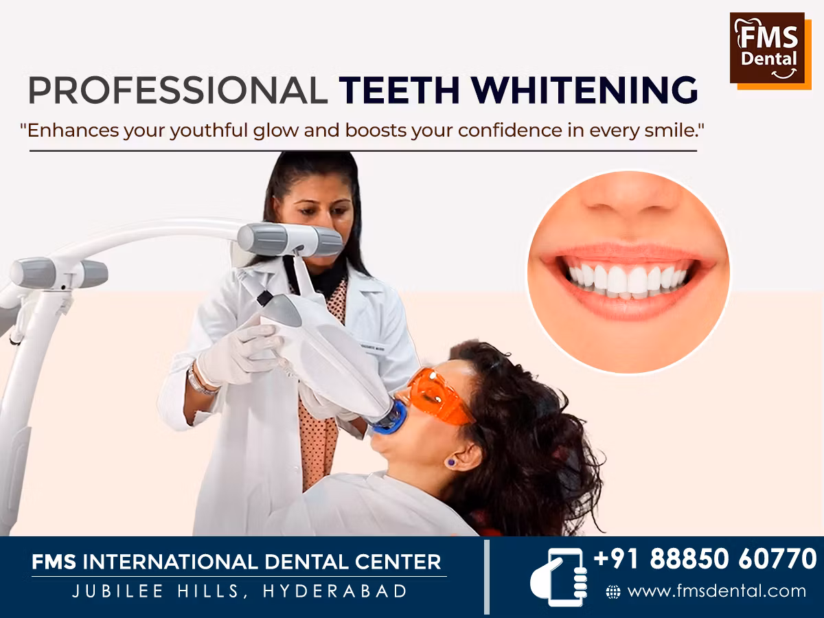 Teeth Whitening
