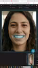 smile design