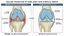 Knee Recovery Strategy